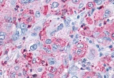 Immunohistochemistry: Mas Antibody [NBP3-14397]